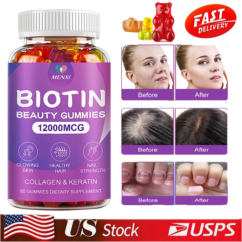3 Pack Vitamatic Biotin Gummies 12000 mcg for Stronger Hair Skin Nails 60 Vegan
