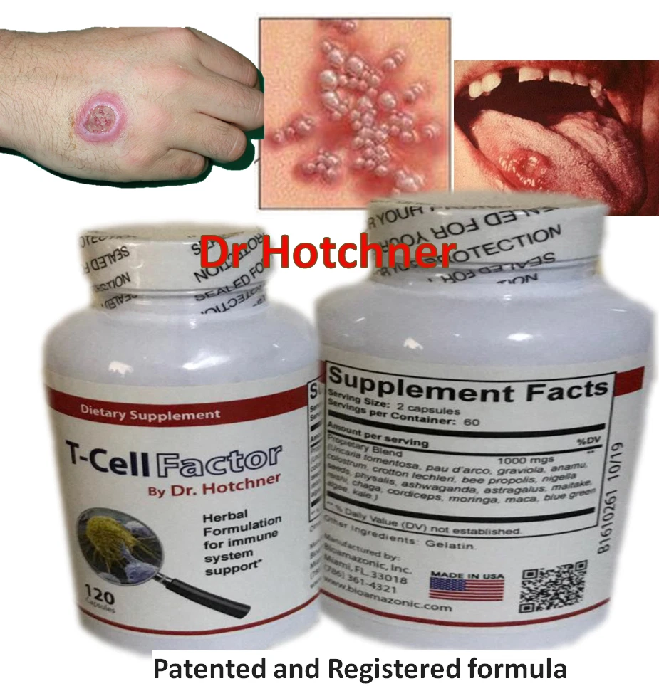 candida MOUTH Support SKIN PARTS OF THE BODY candida defense Support