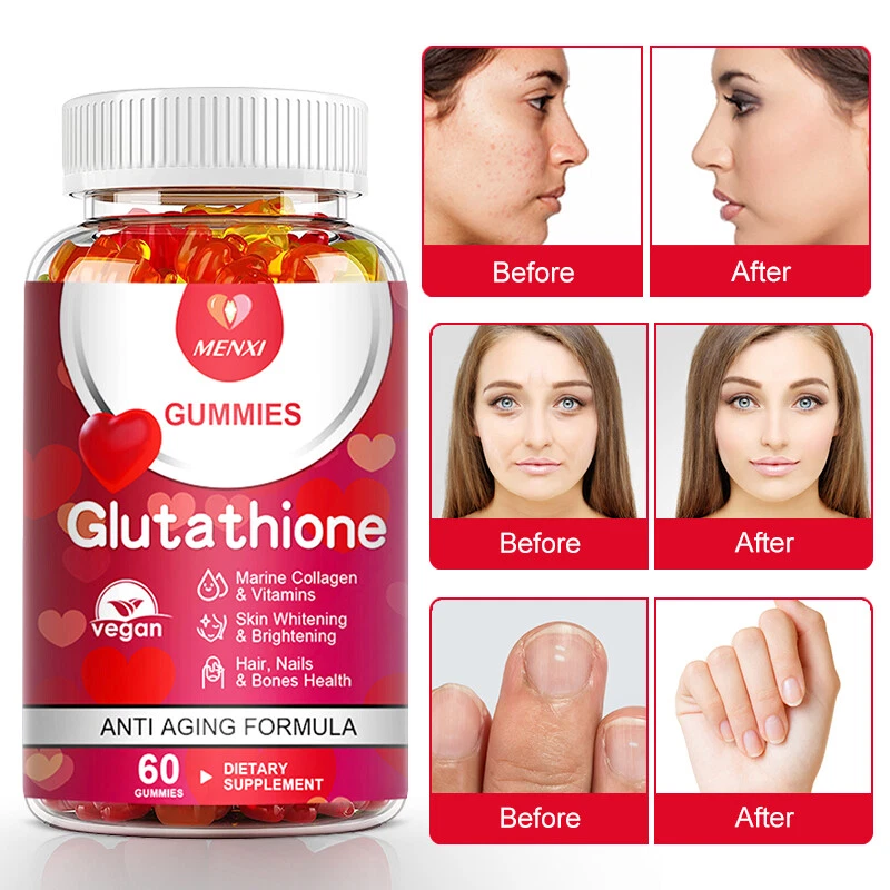 Best Glutathione Skin Whitening Gummies Natural Anti Aging Supplement for Beauty
