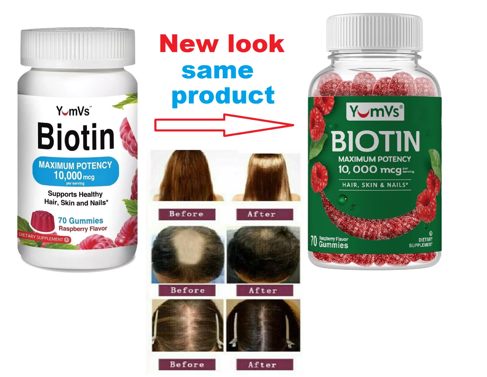 Gomitas de Biotina Vitaminas Para La Caida Del Cabello Evita La Perdida De Pelo